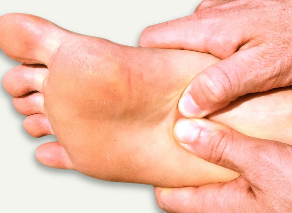 foot pain - Plantar fasciitis